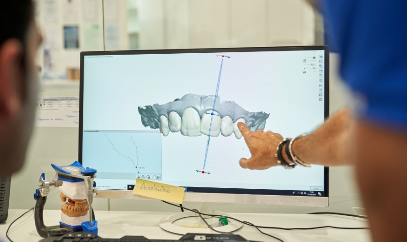 dental digital impressions system