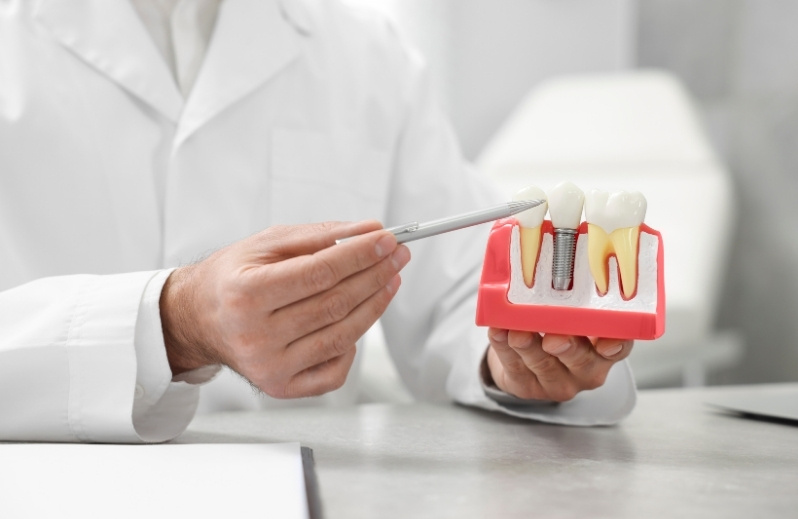 best practices to care for your dental implants